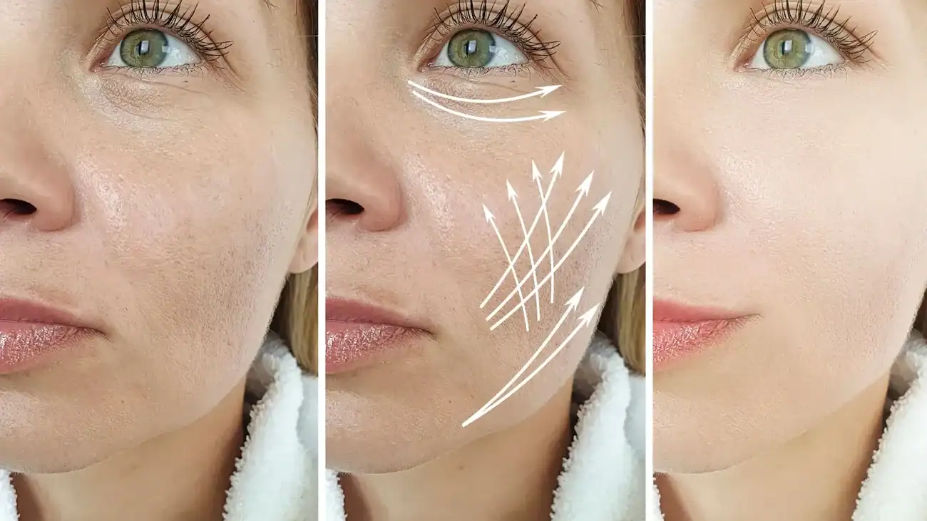 Can One Treatment Really Tackle More Than One Skin Concern Edgware?