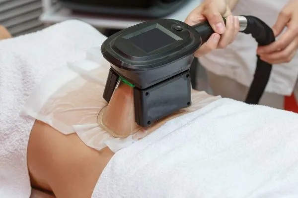 Image of person having fat freezing treatment to help weight gain Edgware