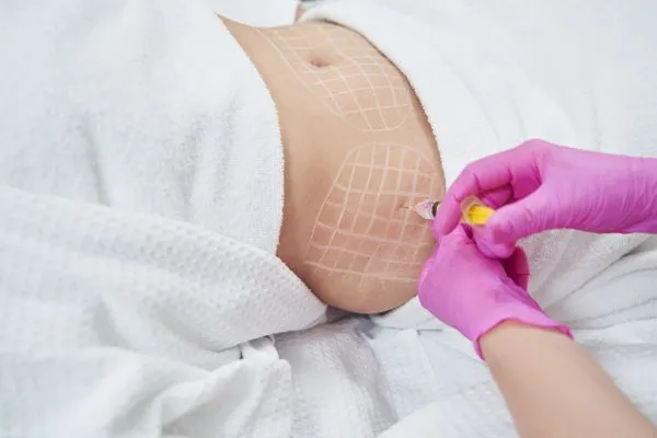 image of fat dissolving injections on love handles to help combat weight gain Edgware