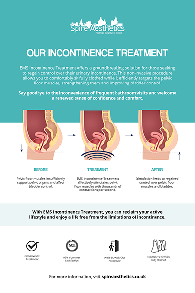 image to show how EMS treatment works for female urinary incontinence Edgware