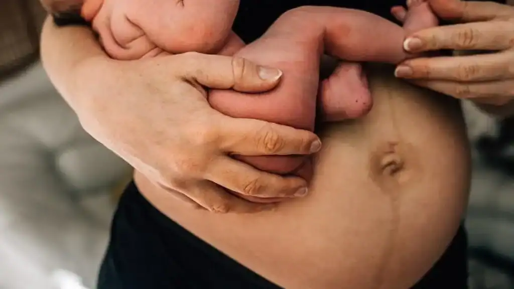 Why Is My Stomach Still Big After Pregnancy Edgware?